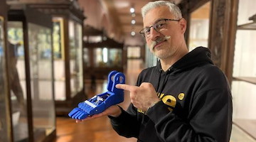 Da Sarno a New York, il tecnico Gaetano Carlino tra i realizzatori di una gamba bionica con movenza delle dita